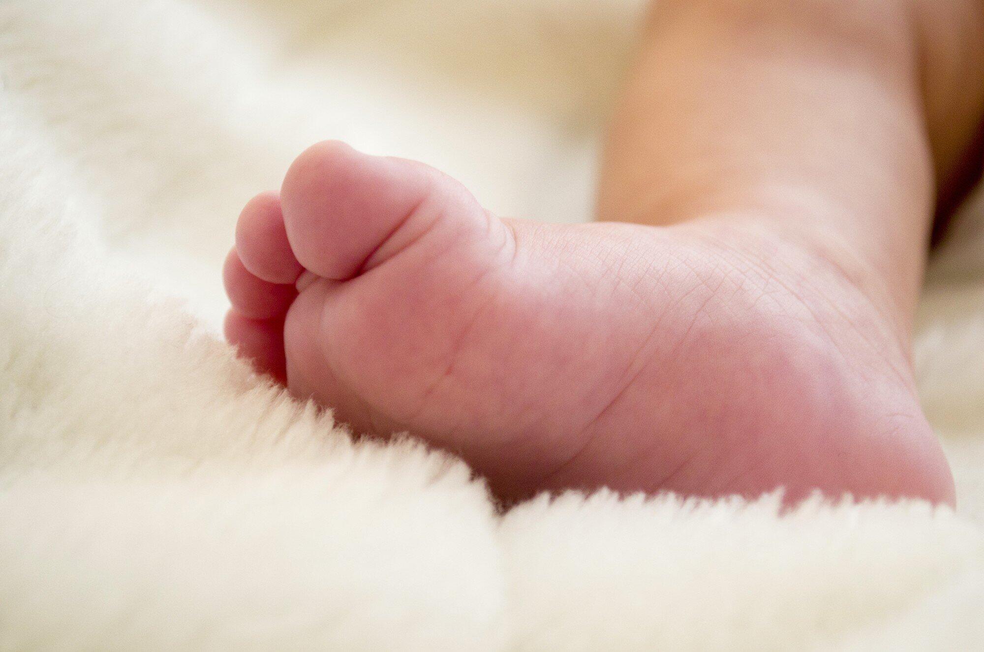 Common Types of Birth Injury Cases and Legal Options